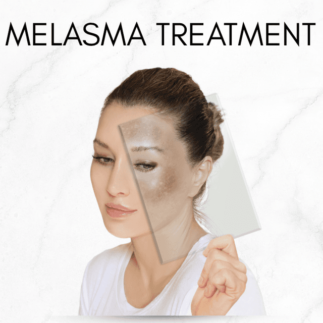 Melasma Treatment 6 sessions at Derma Aesthetics by Juvy in Brea, CA