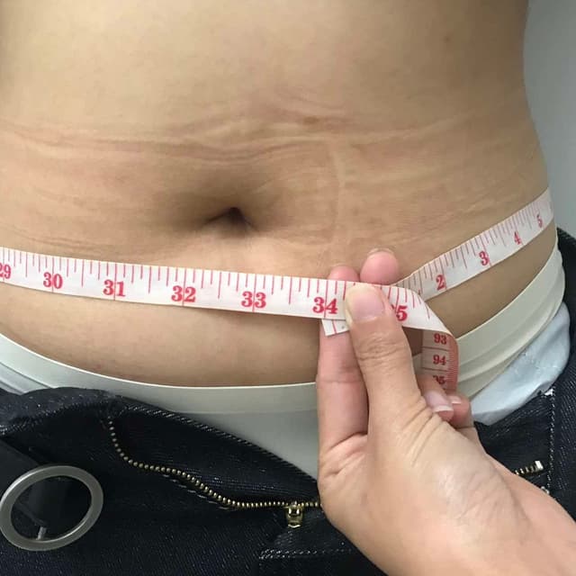 Waist Slimming - 6 sessions at Derma Aesthetics by Juvy in Brea, CA